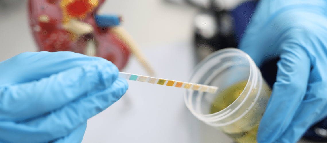 Valeurs des tests d'urine de chien